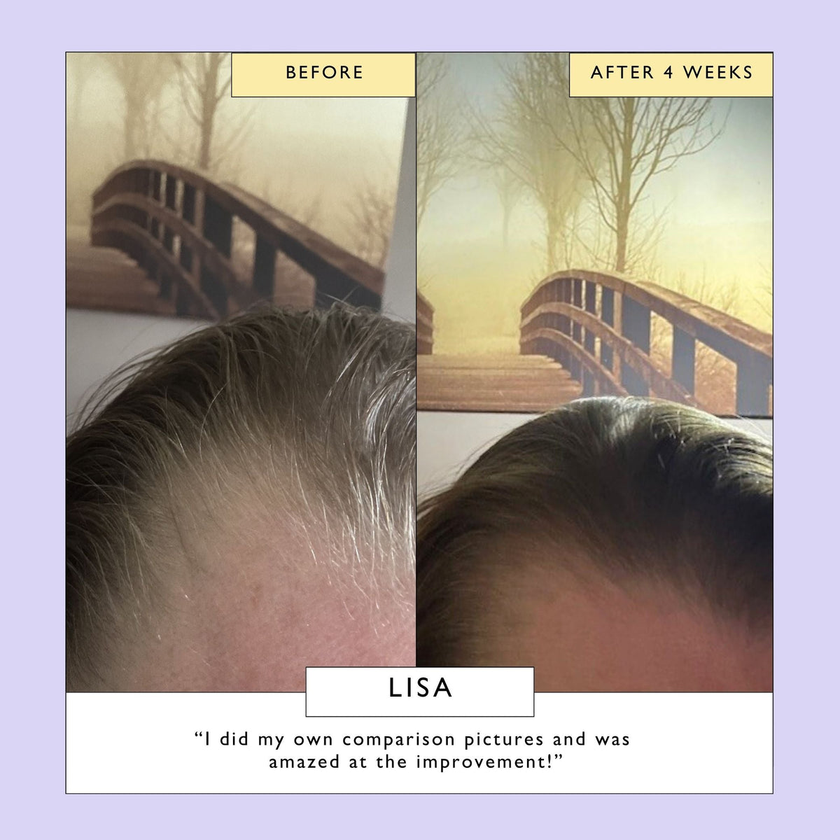 Scalp + Hair Oil (with Bacuri Butter + Castor Oil)