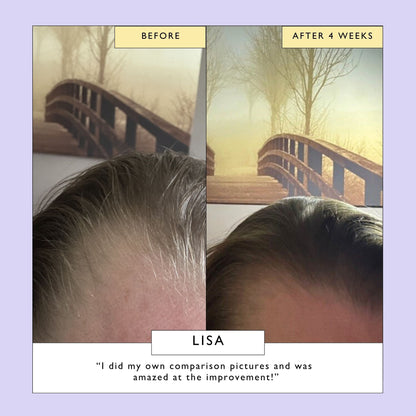 Scalp + Hair Oil (with Bacuri Butter + Castor Oil)