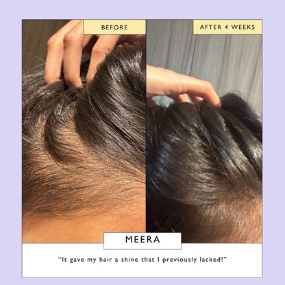 Scalp + Hair Oil (with Bacuri Butter + Castor Oil)