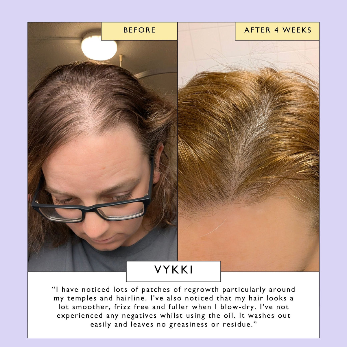 Scalp + Hair Oil (with Bacuri Butter + Castor Oil)